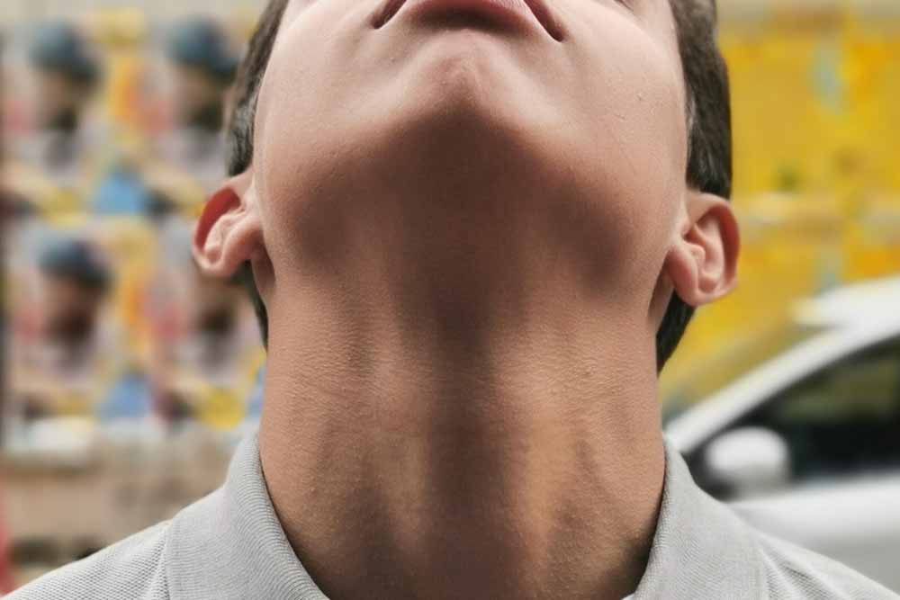 man extended neck showing thyroid